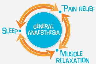 General Anaesthesia